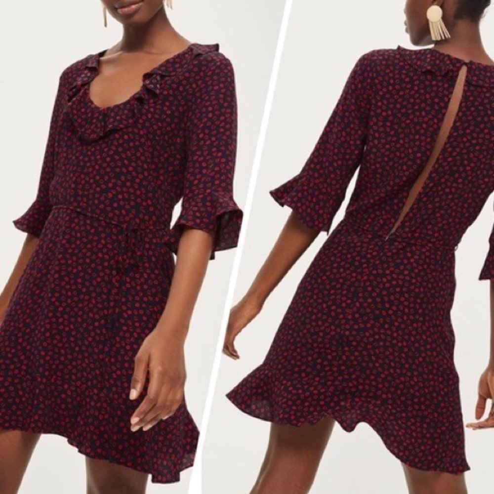 NWT TopShop Lip Print Open Back Dress